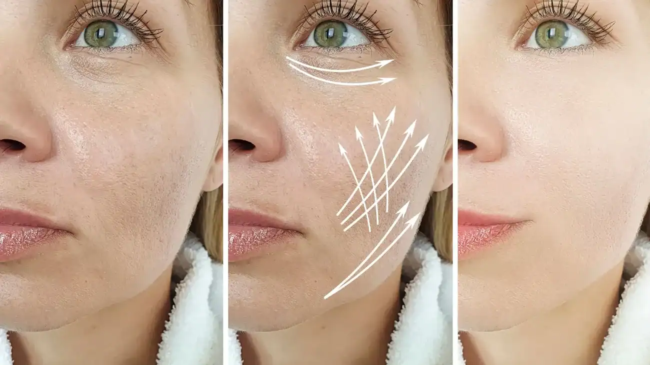 Can One Treatment Really Tackle More Than One Skin Concern Chipping Norton?
