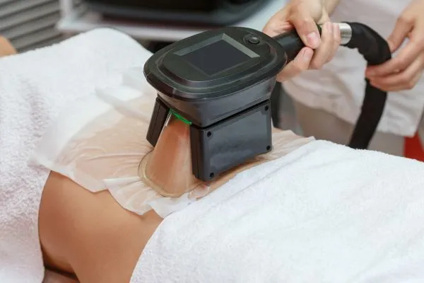 Image of person having fat freezing treatment to help weight gain Chipping Norton