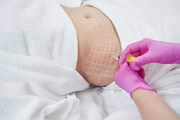 image of fat dissolving injections on love handles to help combat weight gain Chipping Norton