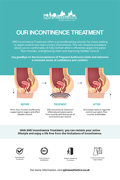 image to show how EMS treatment works for female urinary incontinence Chipping Norton