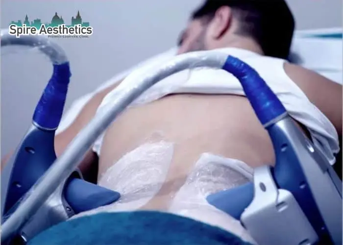 Man having fat freezing treatment done on love handles before a competitions Chipping Norton to create a sculpted look.