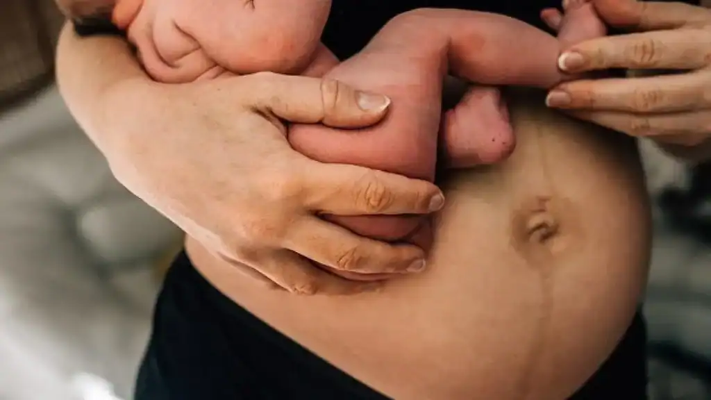 Why Is My Stomach Still Big After Pregnancy Chipping Norton?